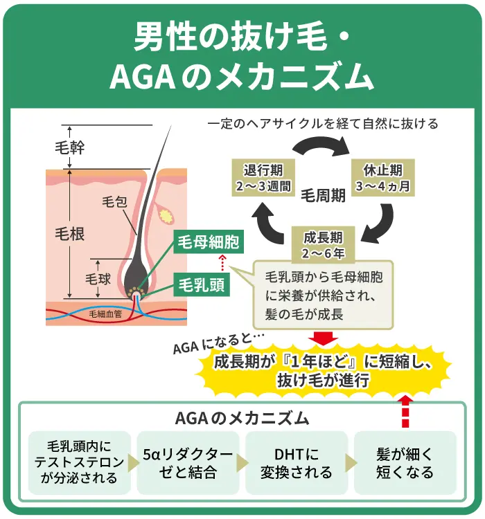 男性の抜け毛・AGAのメカニズム