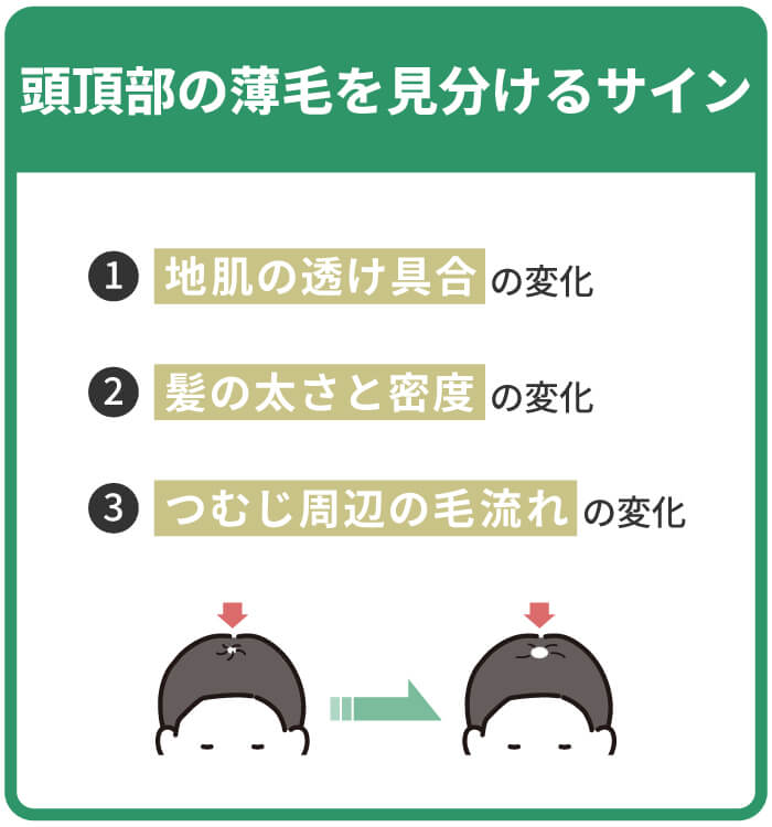 頭頂部の薄毛を見分けるサイン