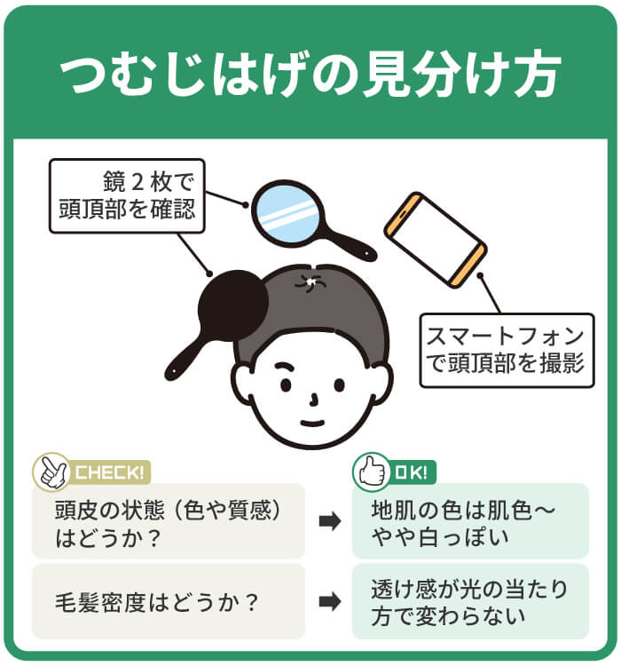 つむじはげの見分け方